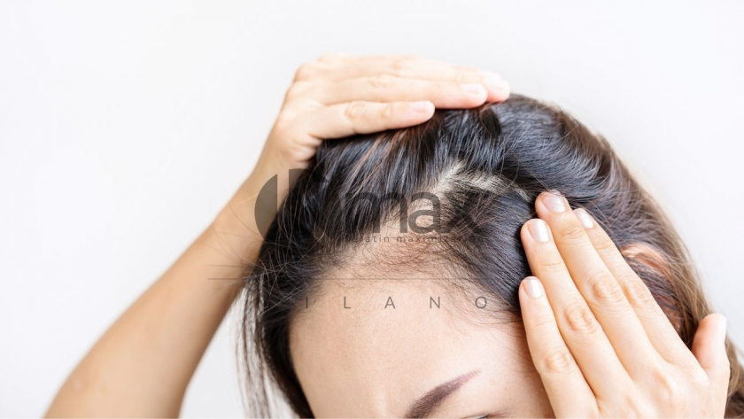 Male pattern baldness Causes and treatment