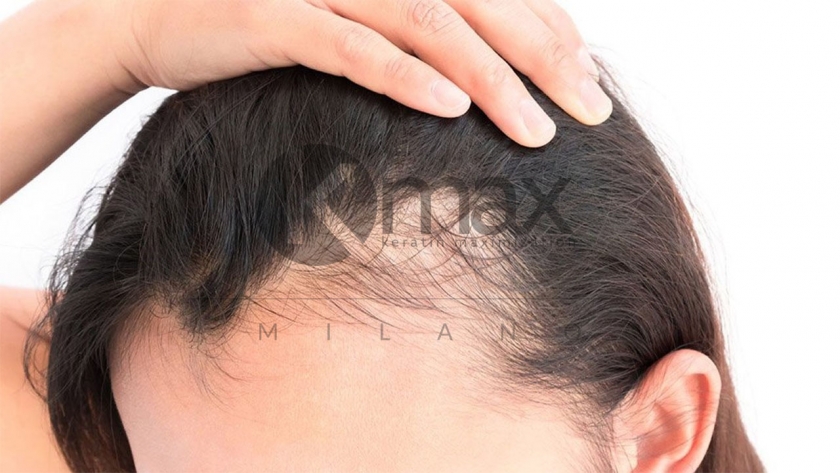 Hair Loss in Women: Causes and Treatments for Every Age - GoodRx