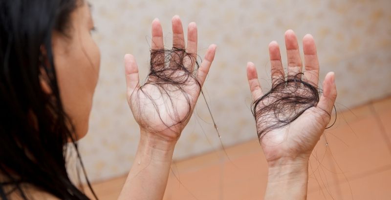hair loss remedies