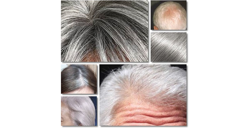 White Hair: Which are the Causes and How to Fight Them? - Your Instant Hair  Makeup Hair Fiber Kmax